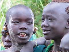 This young Suri girl has had two of her lower teeth removed in order to ultimately put a lip plate.