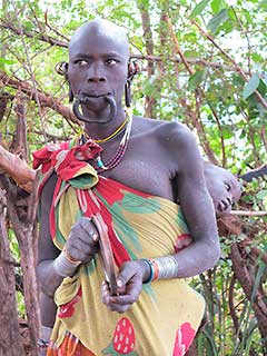 When the Surma women remove their lip plate this is what the lower lip looks like.