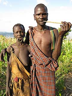 When the Suri women remove their lip plate this is what the lower lip looks like.